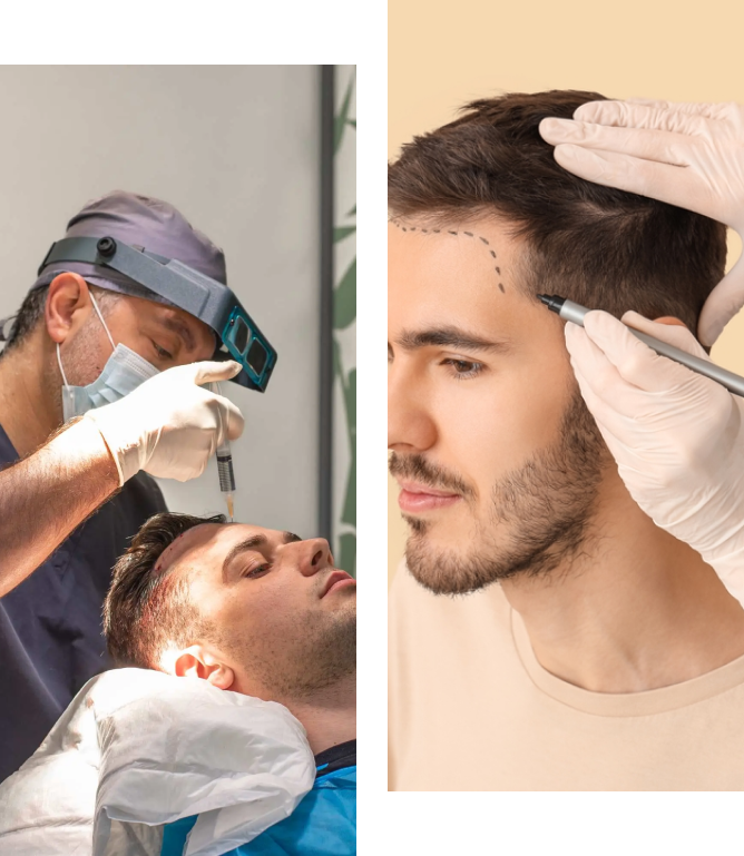 Hair restoration outline and procedure