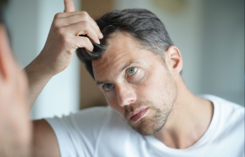 Hair Transplants