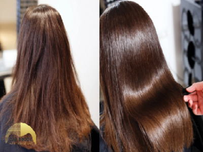 Hair Restoration