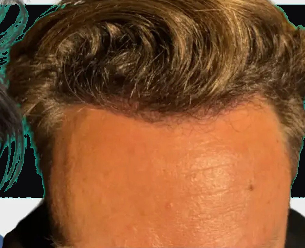The same patient after treatment