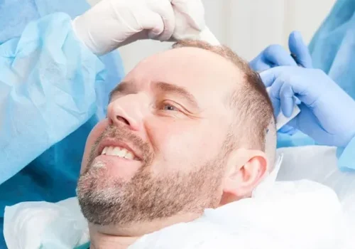 Hair Transplantation